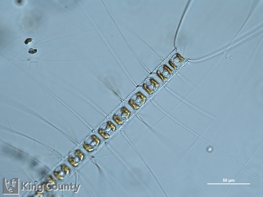 Photo of Chaetoceros vanheurckii